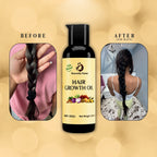 Hair Regrowth Kit – Oil + Tonic