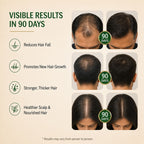 90-Day Hair Growth Bundle – Supplements + Shampoo + Free Hair Oil